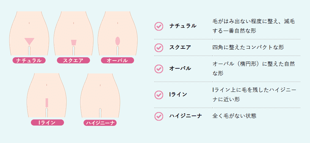 VIO脱毛のVラインのデザイン画像