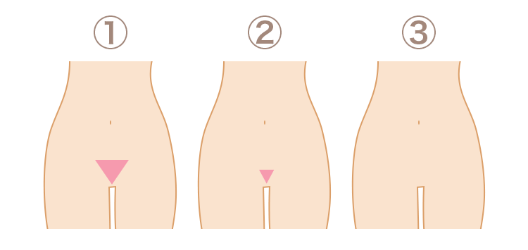 Vラインの状態のイラスト画像